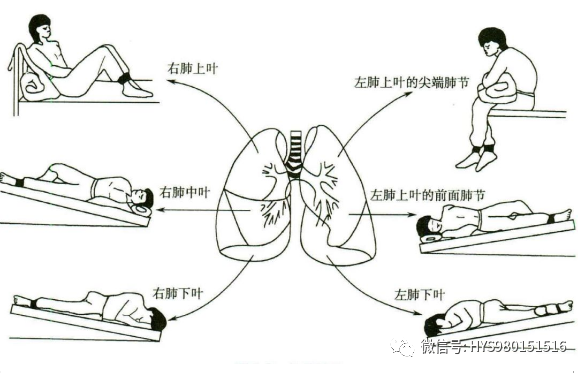 慢阻肺-痰多-咳痰-排痰-氣道廓清-康復(fù)-肺病-呼吸-肺功能檢測儀