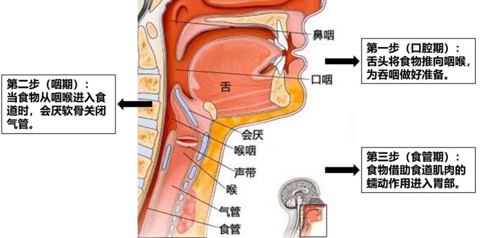 吞咽-吞咽障礙-吃飯-進食困難-嗆咳-咳嗽-咳痰-吸入性肺炎-呼吸肌-呼吸機-冷刺激治療-腹式呼吸-縮唇呼吸-呼吸訓(xùn)練器-唾液吞咽-進食體位管理-肺功能-肺功能檢測儀-肺炎-通氣